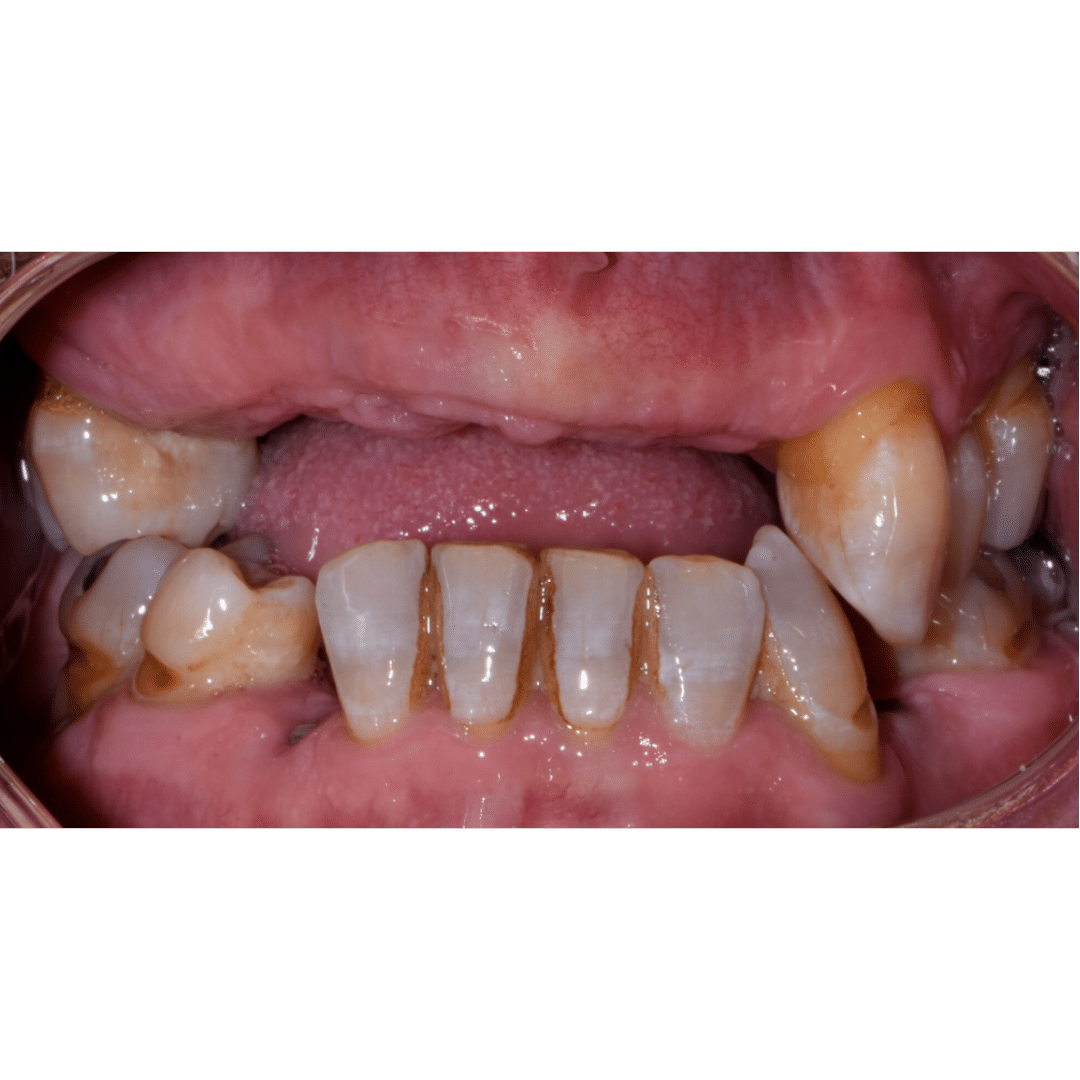 Before image
