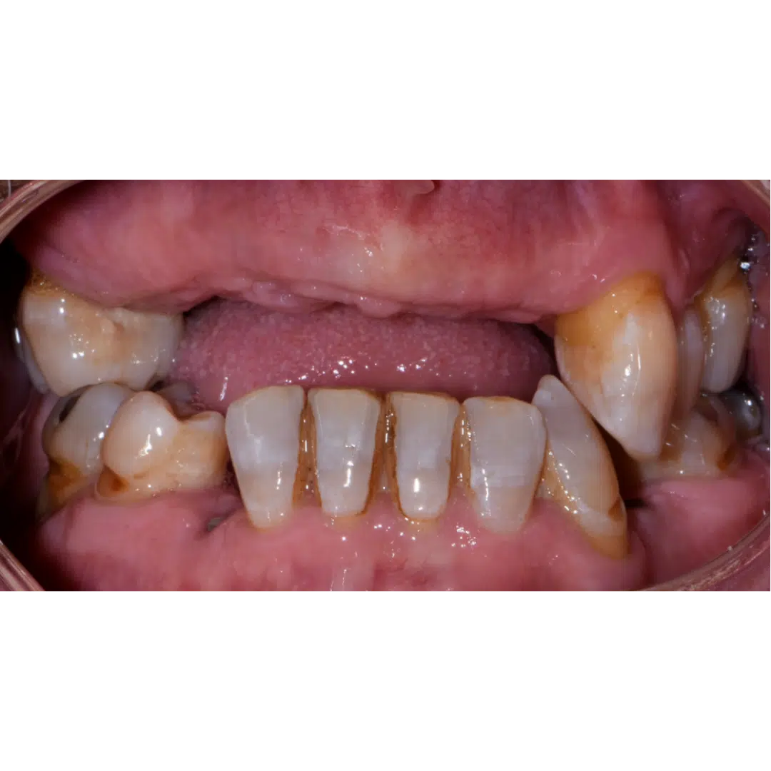 Before image