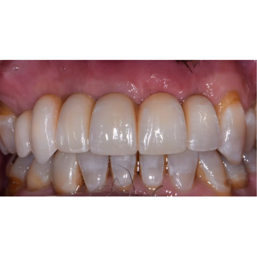 After image